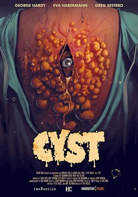 Cyst (2020)