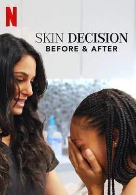 Skin Decision: Before and After (2020)